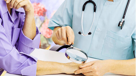 Diagnose en behandeling van papilloma's